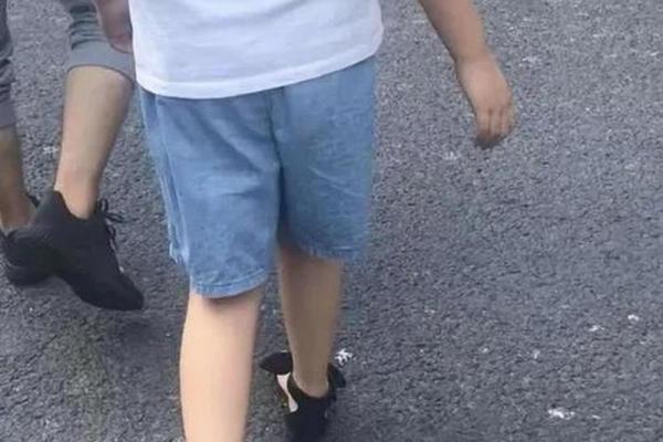 小孩走路内八字或者外八字有问题吗？该如何纠正？