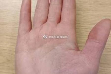 去算命回来就发烧了