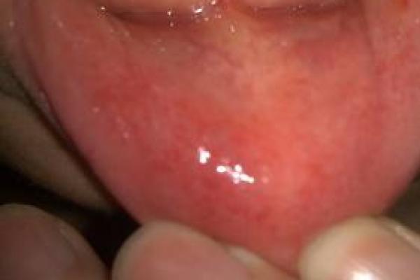 下嘴唇不停的跳动吉凶测试