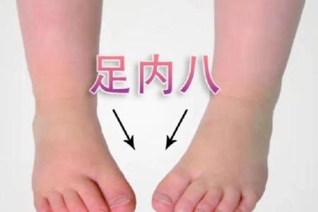 内八字危害