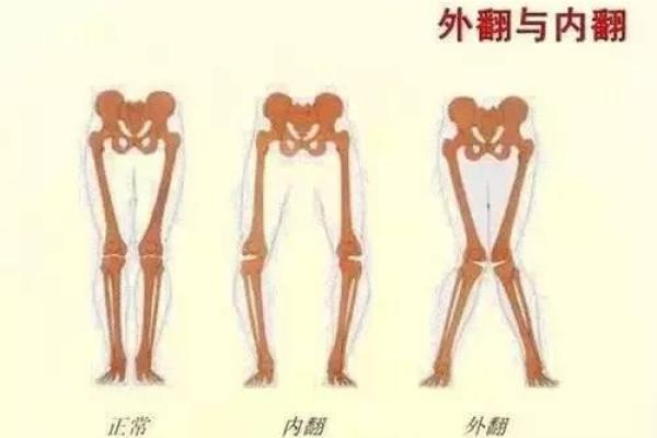 内八字和外八字