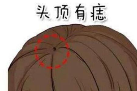 神仙下凡投胎的痣七星图 神仙投胎后身上的七颗神秘痣为何会排列成星座形状