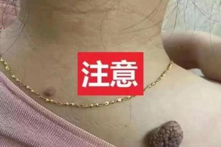 风水上女生脖子后面有痣代表什么啊