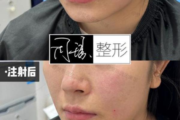 八字纹填充