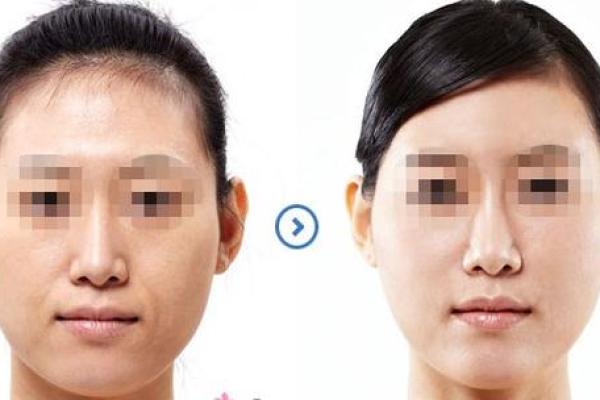 八字与皮肤 八字影响肤质